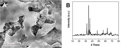 Preparation of Electrochemical Sensor Based on Zinc Oxide Nanoparticles for Simultaneous Determination of AA, DA, and UA